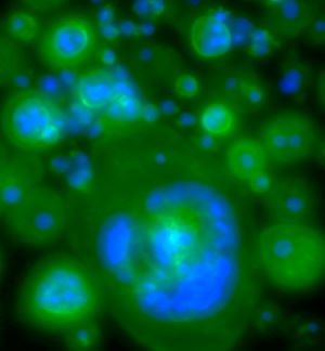 click/tap to enlarge this image... Confocal image of Bone resorbing cells